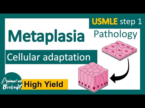 Video: Metaplasia