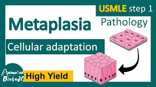 Metaplasia | Cellular adaptation | examples of metaplasia