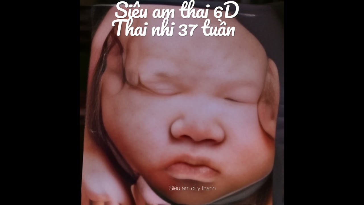 Siêu âm thai 6d thai nhi 37 tuần tuổi - youtube