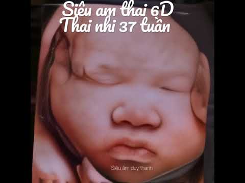 Video Siêu âm thai 6d thai nhi 37 tuần tuổi - youtube