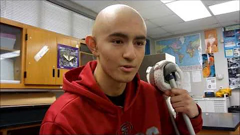 The Story Of 16 Year Old Alex Parra Who Lost His L...