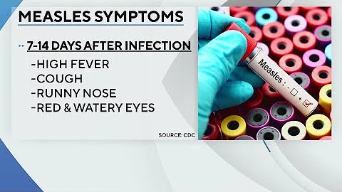 Measles cases on the rise across the country