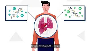 Alpha-1 Antitrypsin Deficiency (AATD) and liver disease awareness