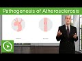 Pathogenesis of Atherosclerosis – Vascular Medicine | Lecturio