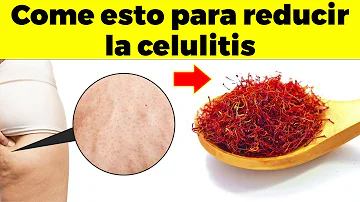 ¿Qué dejar de comer para eliminar la celulitis?