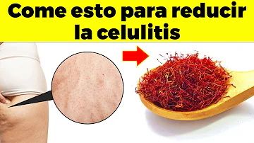 ¿Qué alimentos desencadenan la celulitis?