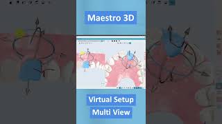 Maestro 3D | Dental Studio Expert | Virtual Setup Multi View