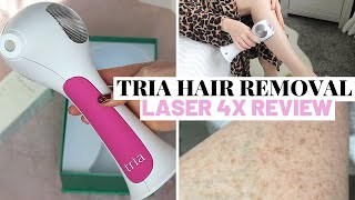 TRIA HAIR REMOVAL LASER 4X REVIEW, DEMO & 6 MONTH RESULTS