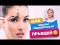 КАК ИЗБАВИТЬСЯ ОТ ПРЫЩЕЙ? || КУШНИРЕНКО