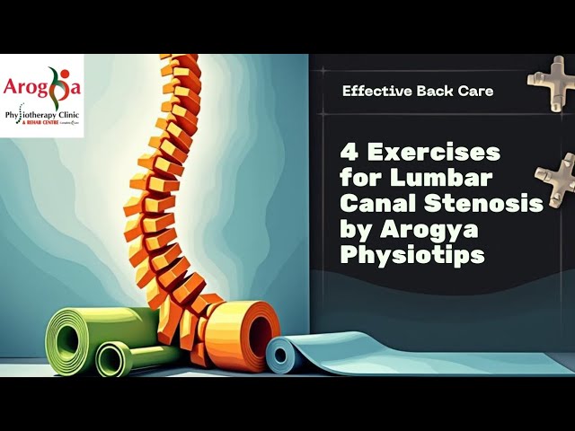 5 exercises for Lumbar Canal Stenosis: Arogya physiotips #lumbarcanalstenosis