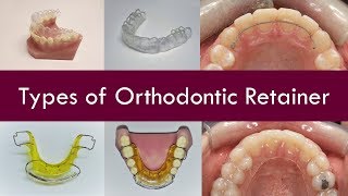 What types of Orthodontic Retainer are there?  |  Dr. Jiten Vadukul  |  The Orthodontist