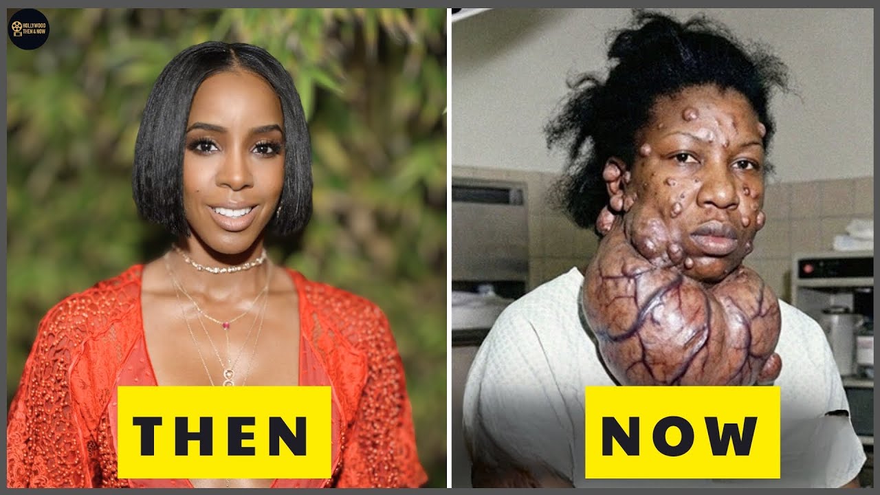 10 Black Celebs With The WORST Plastic Surgery | Then and Now 2026
