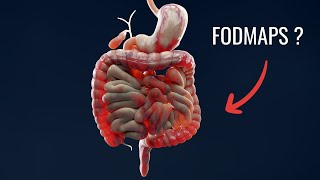 The Low FODMAP Diet Beginner’s Guide