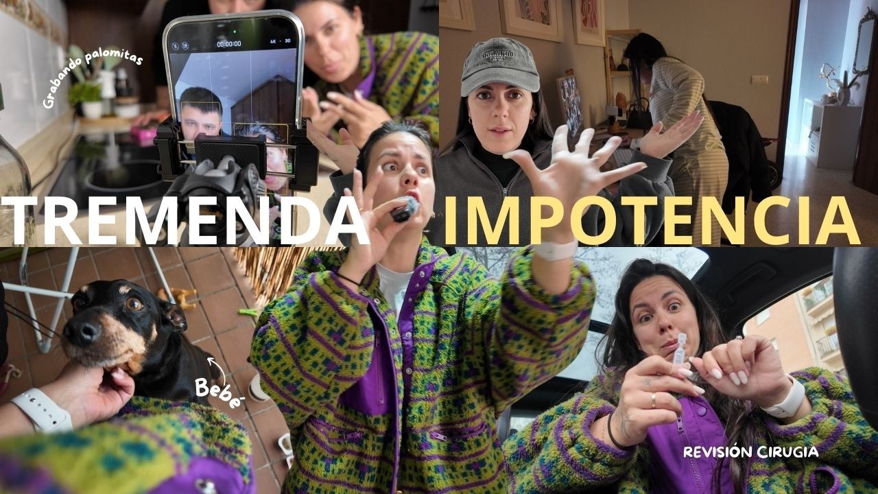 TREMENDA IMPOTENCIA 😡 | REVISIÍON de mi OPERACIÓN de 👀 | me quedan HORRIBLES! 😭 |