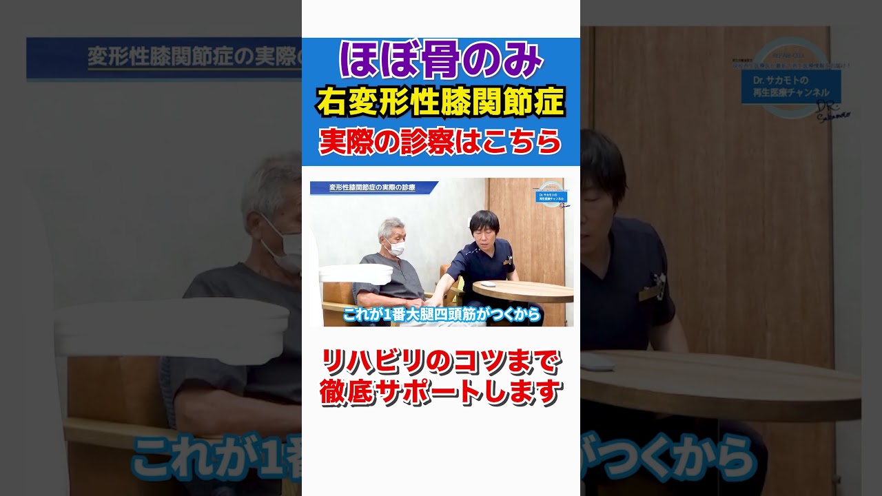 膝を診る目 診断・治療のエッセンス 名医の目のつけどころ Osteoarthritis of the Knee] My knee is almost entirely bone! I'm