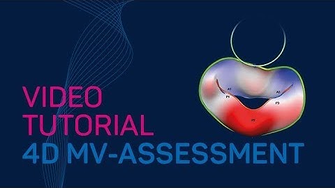 4D MV-ASSESSMENT Video Tutorial #TTA2.30