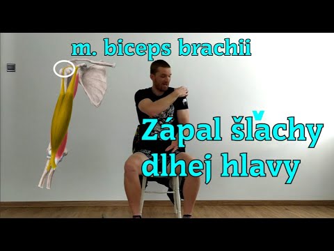 Video: Čo je operácia bicepsu?