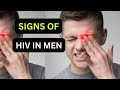 10 HIV Symptoms In Men After 1 Week Explained By HIV Doctor 10 HIV Symptoms In Men After 1 Week Explained By HIV Doctor