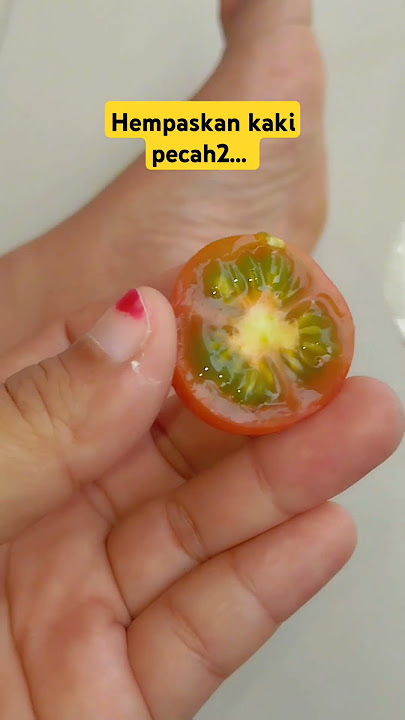 Tips atasi kaki pecah pecah dengan bahan alami