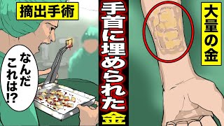 【漫画】患者の手首からパンパンに詰まった金が大量放出...なぜ大量の金が手首に埋まっていたのか？ゾッとする結末・・・（マンガ動画）