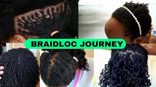 Braidlocs Journey.