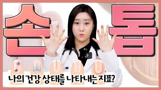 (ENG)내 손톱을 보면 답을 알 수 있다? 손톱으로 보는 건강상태!