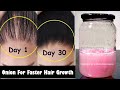 How To Use Onion Juice For Extreme Hair Growth - 15 Days Challenge for Longer and Thicker Hair