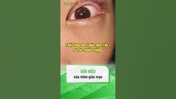 DẤU HIỆU CỦA VIÊM GIÁC MẠC |#shorts