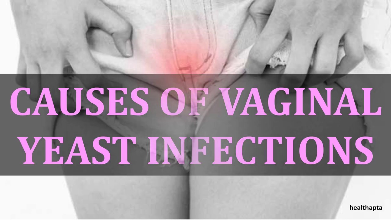 Causes Of Vaginal Yeast Infections Youtube