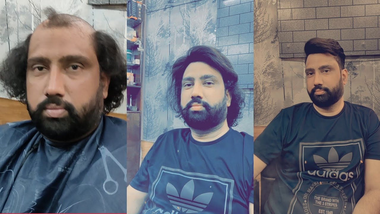 Hair patch ludhiana 2 hair style non surgical hàir treatments