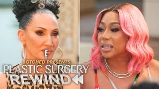 Jessica Dime Reveals Bbl & Filler Complications Plastic Surgery Rewind E