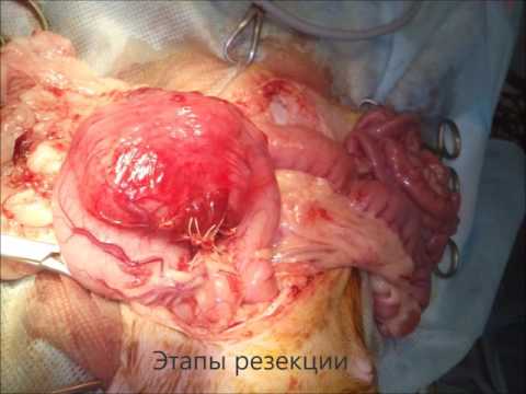 Video: Daim Tawv Nqaij Mob Cancer (Epidermotropic Lymphoma) Hauv Cats