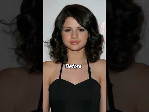 Selena Gomez: Before and After - A Look at Her Transformation