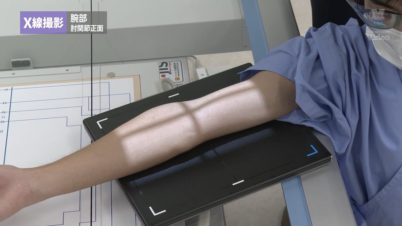 X線撮影 腕部 ｜ Medical*Online Video