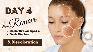 Winter Skin Transformation Challenge (Day 4) : Remove Dark/Brown Spots, Dark Circles & Discoloration