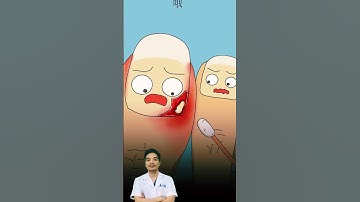 Cắt Khóe Móng Chân #nhakhoa #suckhoe