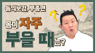 [경제따라 동의보감]몸이 많이 부어오른다면?! 동의보감에 나온 부종에 대하여