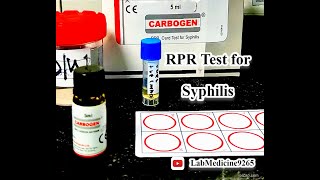 Rapid Plasma Reagin (RPR) Test || Serology || @tulipdiagnosticspvtltdgoa