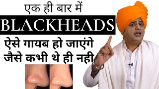 Blackheads जड़ से खत्म करने के लिए Get Rid of Blackheads || Sanyasi Ayurveda || screenshot 2