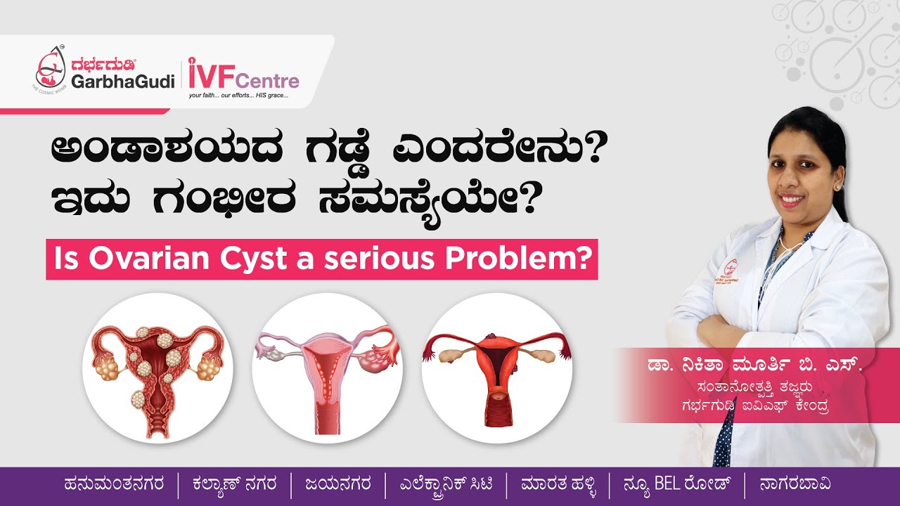 ಅಂಡಾಶಯದ ಗಡ್ಡೆ ಎಂದರೇನು? ಇದು ಗಂಭೀರ ಸಮಸ್ಯೆಯೇ? | Is Ovarian Cyst a serious problem?