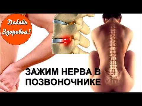 Видео: Защемление нерва в верхней части спины: причины, лечение и многое другое