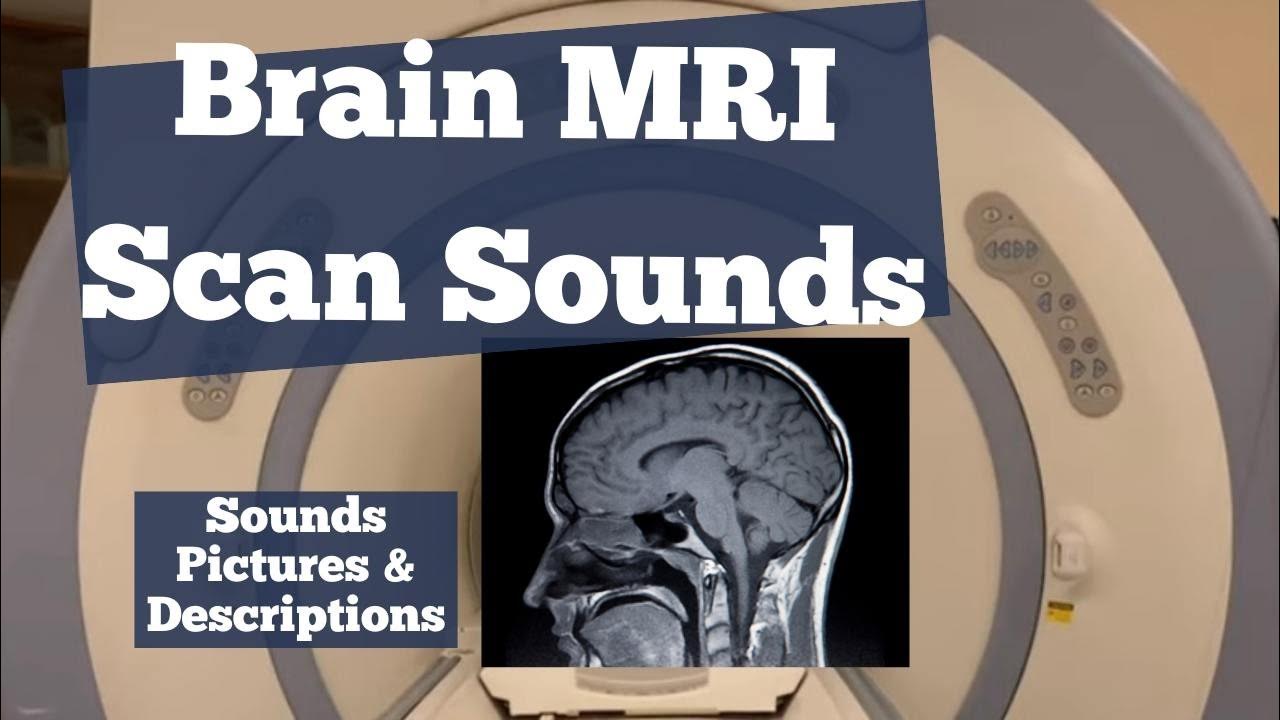 MRI Scan Sounds Explained Exploring Brain MRI Scan Sounds and