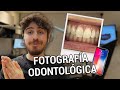Fotografías odontológicas con el celular | Odontología a distancia