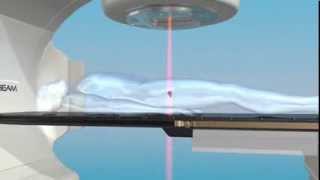 TrueBeam Image-Guided Radiation Therapy