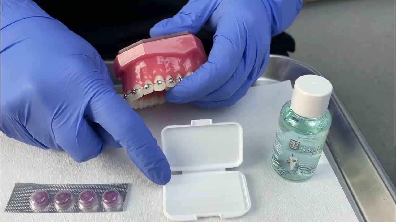 Essential Brace Care Kit YouTube