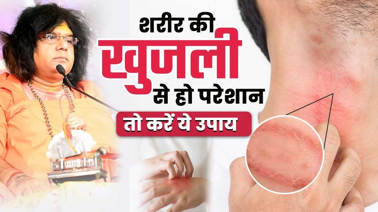 खुजली का घरेलु उपाय | खुजली से हो परेशान तो करें ये उपाय | Acharya Shri Kaushik Ji Maharaj