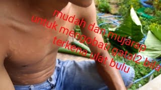 Cara mudah mengobati gatal gatal bila terkena ulat bulu