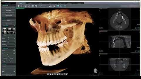Vatech Ez3D-i 5.1 CBCT Software