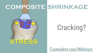 How to be more efficient with bulkfill composites