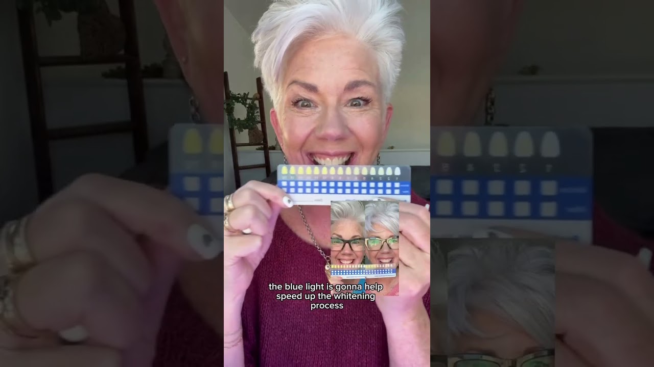 A smile glow up ☀️ Here are the deets to our V-Day Sale! 😍 🩷 LIMITED EDITION PINK Compact Pro